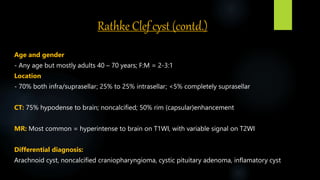Rathke Clef cyst (contd.)
Age and gender
- Any age but mostly adults 40 – 70 years; F:M = 2-3:1
Location
- 70% both infra/suprasellar; 25% to 25% intrasellar; <5% completely suprasellar
CT: 75% hypodense to brain; noncalcified; 50% rim (capsular)enhancement
MR: Most common = hyperintense to brain on T1WI, with variable signal on T2WI
Differential diagnosis:
Arachnoid cyst, noncalcified craniopharyngioma, cystic pituitary adenoma, inflamatory cyst
 
