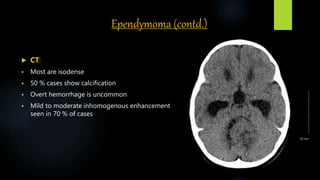 Ependymoma (contd.)
 CT:
 Most are isodense
 50 % cases show calcification
 Overt hemorrhage is uncommon
 Mild to moderate inhomogenous enhancement is
seen in 70 % of cases
 