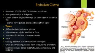 Brainstem Glioma
 Represent 10‐20% of all CNS tumors in children
 Peak presentation at 7‐9 years
 Classic triad of physical findings (all three seen in 1/3 of cas
es):
– Cranial nerve palsies, ataxia and Long tract signs
 Types:
 Diffuse intrinsic brainstem glioma
 - Most commonly located in the Pons
 - Account for 80% of brainstem tumors
 Focal
 Occupy less than 50% of brainstem subregion.
 Often clearly distinguishable from surrounding brainstem.
 Subtypes include dorsal exophytic, cervicomedullary and
midbrain
 