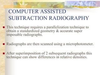Substraction Radiograph Unit Imaging in periodontics | PPTX