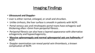 Imaging Findings
• Ultrasound and Doppler-
• Liver is either normal, enlarged, or small and shrunken.
• Unlike cirrhosis, the liver surface is smooth in patients with NCPF.
• Portal venous axis and intrahepatic portal tracts have echogenic wall
thickening often >3mm from periportal fibrosis .
• Periportal fibrosis can also have a layered appearance with alternative
echogenicity and hypoechogenicity .
• Massive splenomegaly and normal splenoportal axis are hallmarks of
NCPF.
• Doppler examination can reveal portal vein thrombosis, a known
complication of NCPF.
 