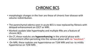 CHRONIC BCS
• morphologic changes in the liver are those of chronic liver disease with
volume redistribution.
• The parenchymal edema seen in acute BCS is now replaced by fibrosis with
delayed enhancement on CECT or MRI.
• Marked caudate lobe hypertrophy and multiple RNs are a feature of
chronic BCS.
• On CT, these nodules are hyperenhancing in the arterial phase with
enhancement often persisting into the venous phase with no “washout.”
• On MRI, these nodules are hyperintense on T1W MRI and iso- to mildly
hypointense on T2W MRI.
 