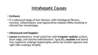 Intrahepatic Causes
• Cirrhosis-
• It is advanced stage of liver disease, with histological fibrosis,
necrosis, inflammation, and regenerative nodules (RNs) resulting in
altered liver morphology.
• Ultrasound and Doppler-
• coarse echotexture, small-sized liver with irregular nodular surface,
blunt edge, and volume redistribution. Typically, caudate and lateral
liver segments undergo hypertrophy, while the medial segment and
right lobe undergo atrophy.
 
