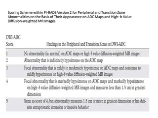 Pi Rads Map Imaging in prostatic patholgy | PPTX