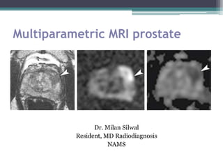Multiparametric MRI prostate
Dr. Milan Silwal
Resident, MD Radiodiagnosis
NAMS
 