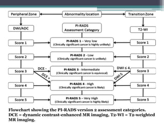 Pi Rads Map Imaging in prostatic patholgy | PPTX
