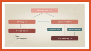 Imaging in pulmonary tuberculosis | PPTX