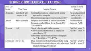 17
PERINEPHRIC FLUID COLLECTIONS
 