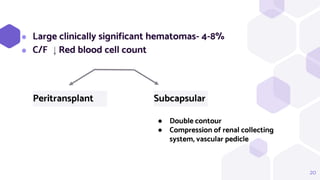 20
⬢ Large clinically significant hematomas- 4-8%
⬢ C/F Red blood cell count
Peritransplant Subcapsular
● Double contour
● Compression of renal collecting
system, vascular pedicle
 