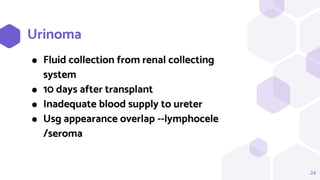24
Urinoma
⬢ Fluid collection from renal collecting
system
⬢ 10 days after transplant
⬢ Inadequate blood supply to ureter
⬢ Usg appearance overlap --lymphocele
/seroma
 