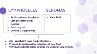 30
LYMPHOCELES SEROMAS
⬢ Sx disruption of lymphatics
⬢ Late post transplant(
months)
⬢ Tend to grow
⬢ Chylous & triglycerides
⬢ Clear fluid
● Usg : anechoic/ hypo fluid collections
● CT round, hypoattenuating collections of clear fluid
● MRI visualizes lymphoceles, seromas and urinomas very similarly
 