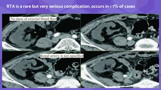 35
RTA is a rare but very serious complication, occurs in < 1% of cases
No signs of arterial blood flow
Renal artery is not opacified
 
