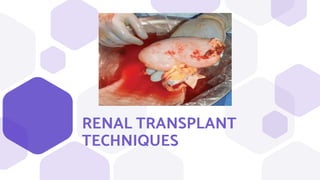 RENAL TRANSPLANT
TECHNIQUES
 