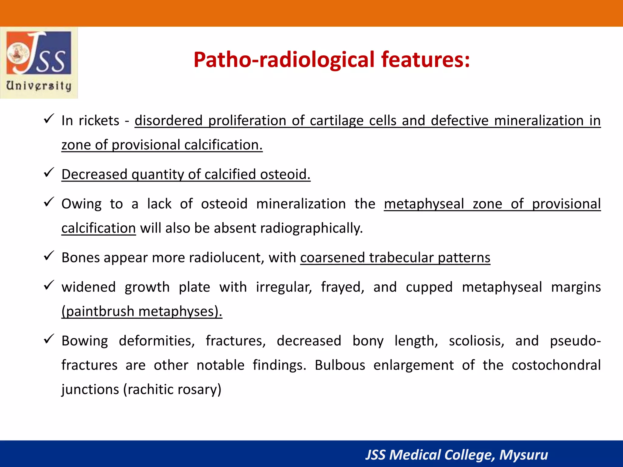 Imaging in rickets | PPTX
