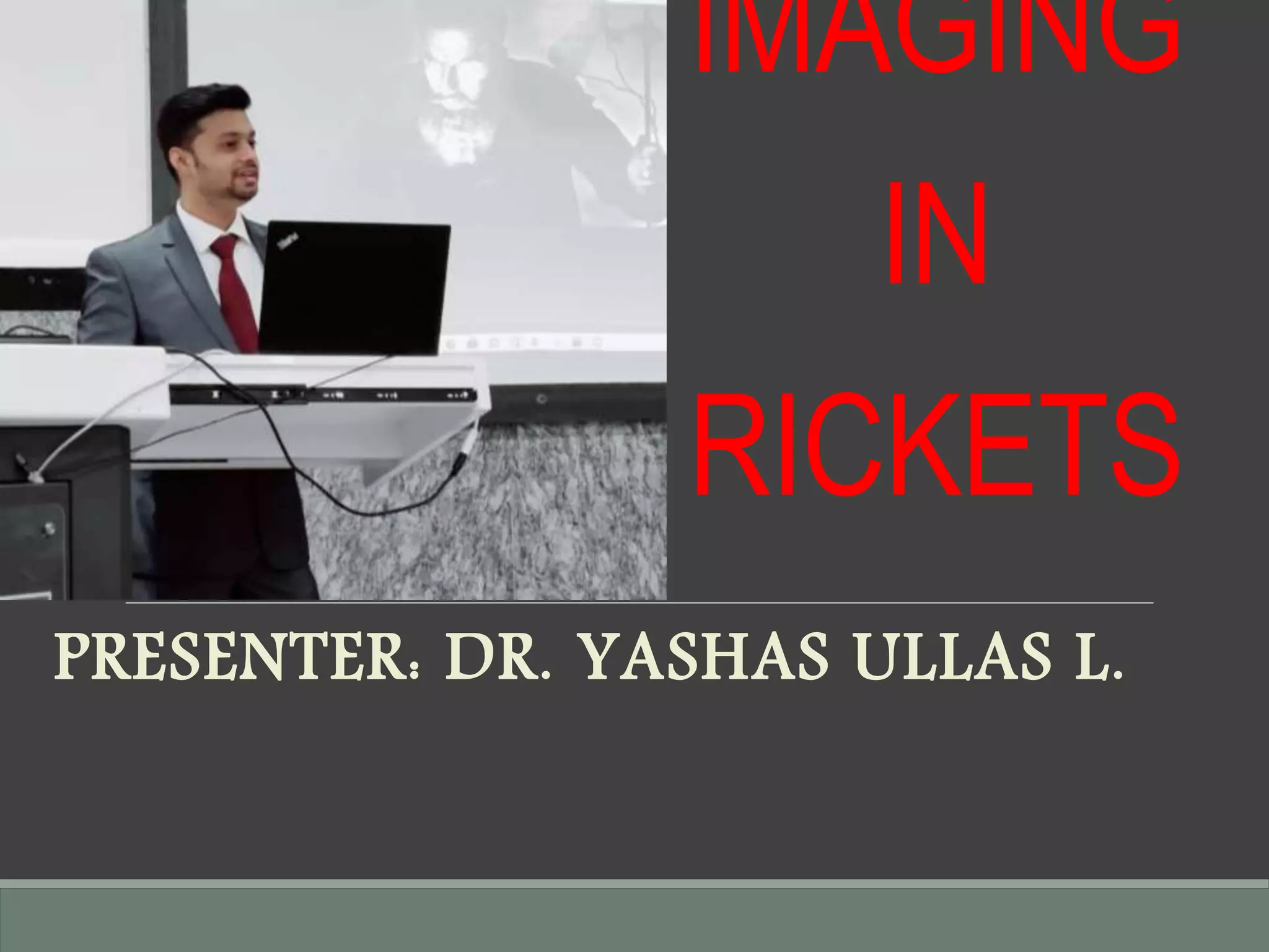 Imaging in rickets | PPTX