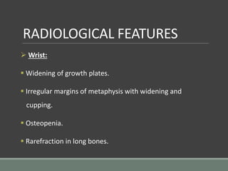 RADIOLOGICAL FEATURES
 Wrist:
 Widening of growth plates.
 Irregular margins of metaphysis with widening and
cupping.
 Osteopenia.
 Rarefraction in long bones.
 
