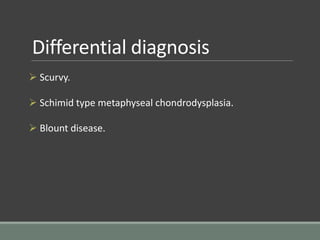 Differential diagnosis
 Scurvy.
 Schimid type metaphyseal chondrodysplasia.
 Blount disease.
 