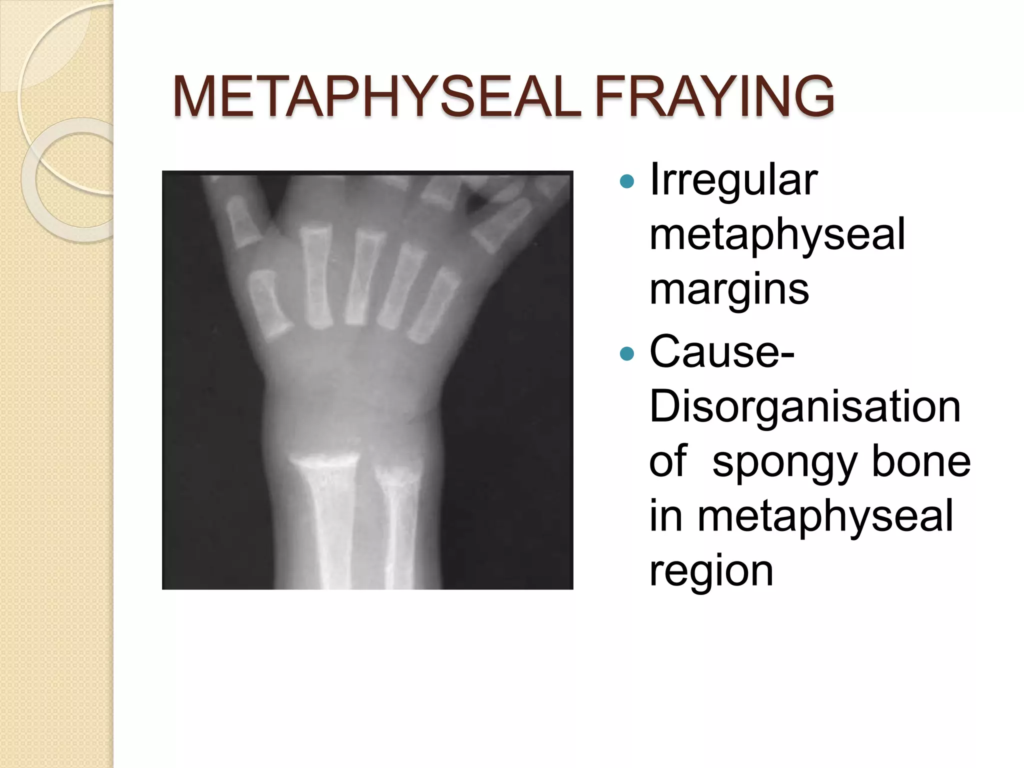 Imaging in Rickets & Scurvy.pptx