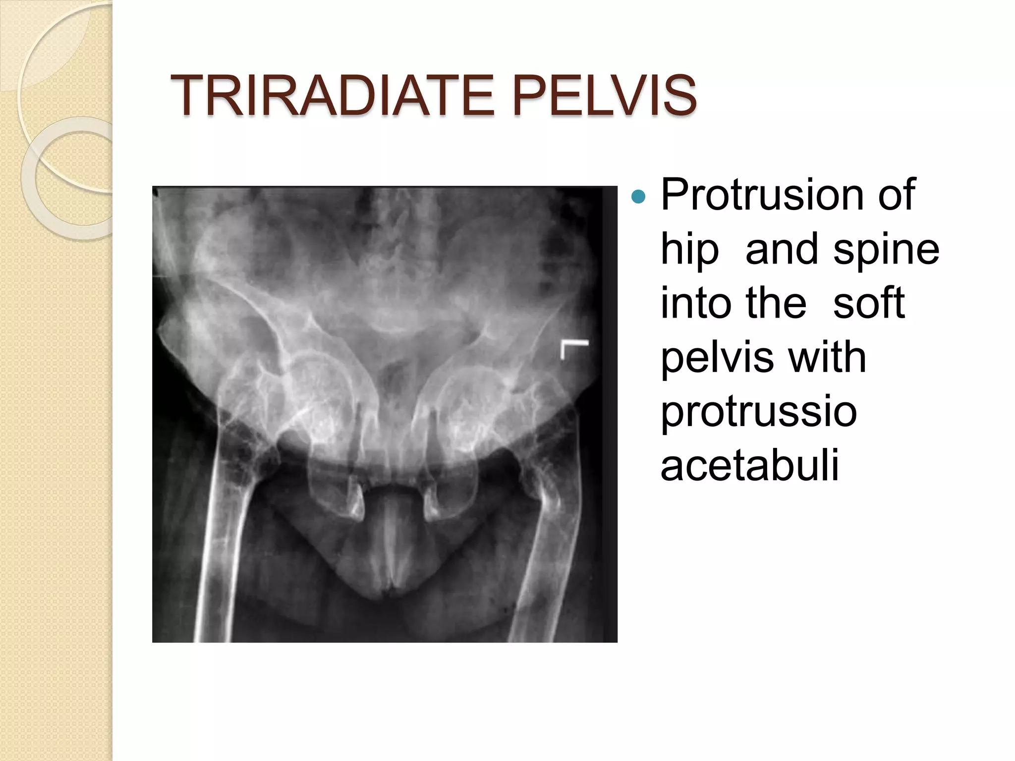 Imaging in Rickets & Scurvy.pptx