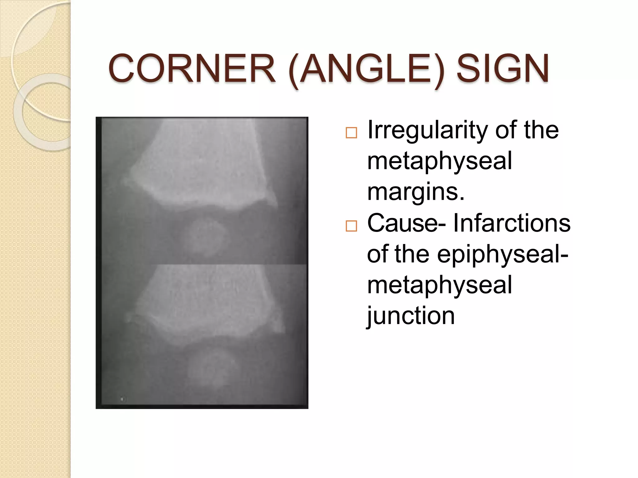 Imaging in Rickets & Scurvy.pptx