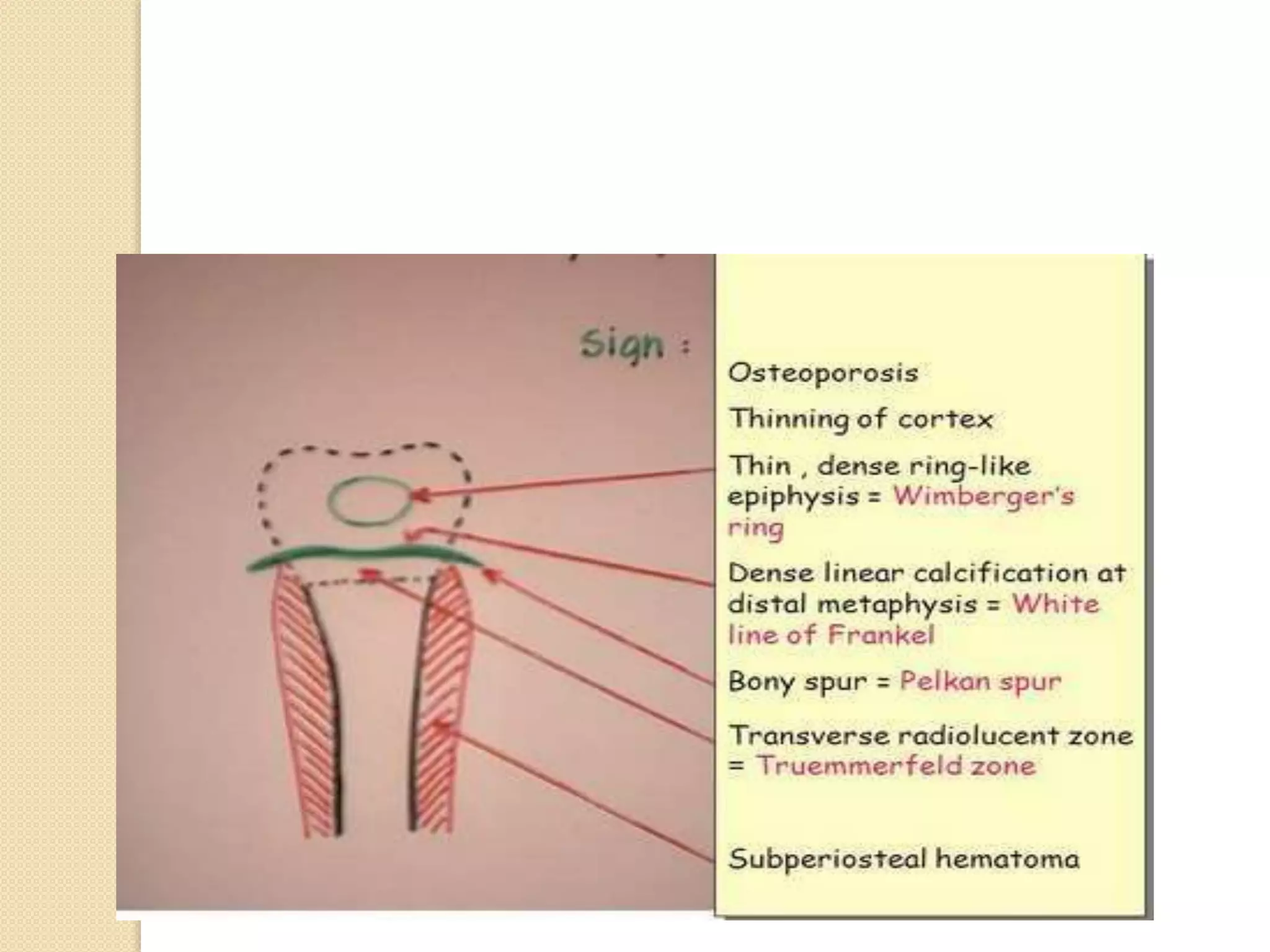 Imaging in Rickets & Scurvy.pptx