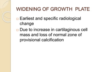 WIDENING OF GROWTH PLATE
 Earliest and specific radiological
change
 Due to increase in cartilaginous cell
mass and loss of normal zone of
provisional calcification
 