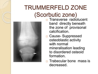 TRUMMERFELD ZONE
(Scorbutic zone)
 Transverse radiolucent
band directly beneath
the zone of provisonal
calcification.
 Cause- Suppressed
osteoblastic activity
with normal
mineralisation leading
to disordered osteoid
formation.
 Trabecular bone mass is
decreased.
 