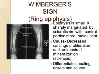 WIMBERGER'S
SIGN
(Ring epiphysis)
 Epiphysis is small &
sharply marginated by
sclerotic rim with central
portion more radiolucent.
 Cause- Decreased
cartilage proliferation
and unimpaired
mineralization
(sclerosis)
 Differentiates healing
rickets and scurvy
 