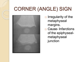 CORNER (ANGLE) SIGN
 Irregularity of the
metaphyseal
margins.
 Cause- Infarctions
of the epiphyseal-
metaphyseal
junction
 
