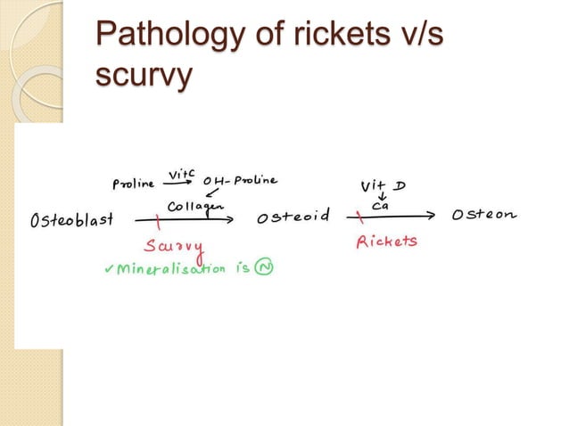 Imaging in Rickets & Scurvy.pptx