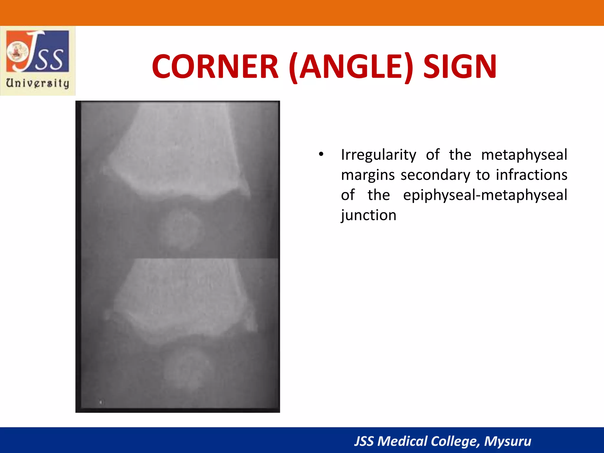 Imaging in scurvy PPT