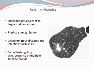 Imaging in solitary pulmonary nodule ppt | PPTX