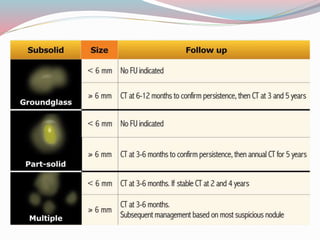 Imaging in solitary pulmonary nodule ppt | PPTX