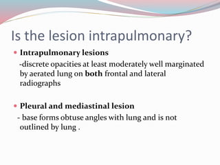 Imaging in solitary pulmonary nodule ppt | PPTX