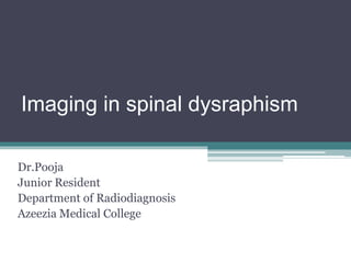 Dr.Pooja
Junior Resident
Department of Radiodiagnosis
Azeezia Medical College
Imaging in spinal dysraphism
 