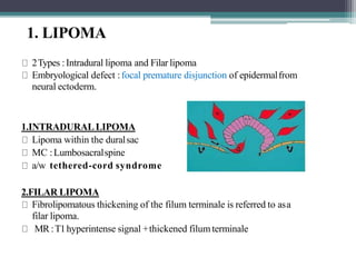 1. LIPOMA
2Types :Intradural lipoma and Filar lipoma
Embryological defect :focal premature disjunction of epidermalfrom
neural ectoderm.
1.INTRADURALLIPOMA
Lipoma within the duralsac
MC :Lumbosacralspine
a/w tethered-cord syndrome
2.FILAR LIPOMA
Fibrolipomatous thickening of the filum terminale is referred to asa
filar lipoma.
MR :T1hyperintense signal +thickened filum terminale
 