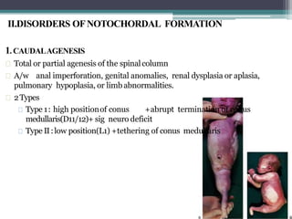 II.DISORDERS OFNOTOCHORDAL FORMATION
1. CAUDALAGENESIS
Total or partial agenesis of the spinalcolumn
A/w anal imperforation, genital anomalies, renal dysplasia or aplasia,
pulmonary hypoplasia, or limb abnormalities.
2Types
Type 1: high positionof conus +abrupt termination of conus
medullaris(D11/12)+ sig neuro deficit
Type II:low position(L1) +tethering of conus medullaris
 