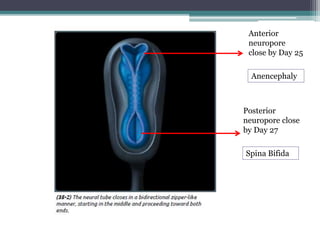 Anterior
neuropore
close by Day 25
Posterior
neuropore close
by Day 27
Anencephaly
Spina Bifida
 