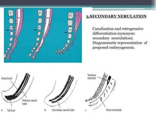 Canalization and retrogressive
differentiation (synonym:
secondary neurulation).
Diagrammatic representation of
proposed embryogenesis.
3.SECONDARY NERULATION
 