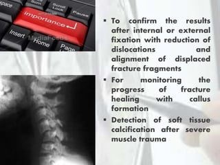 Imaging in sports injury | PPTX