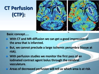 Imaging in stroke | PPTX