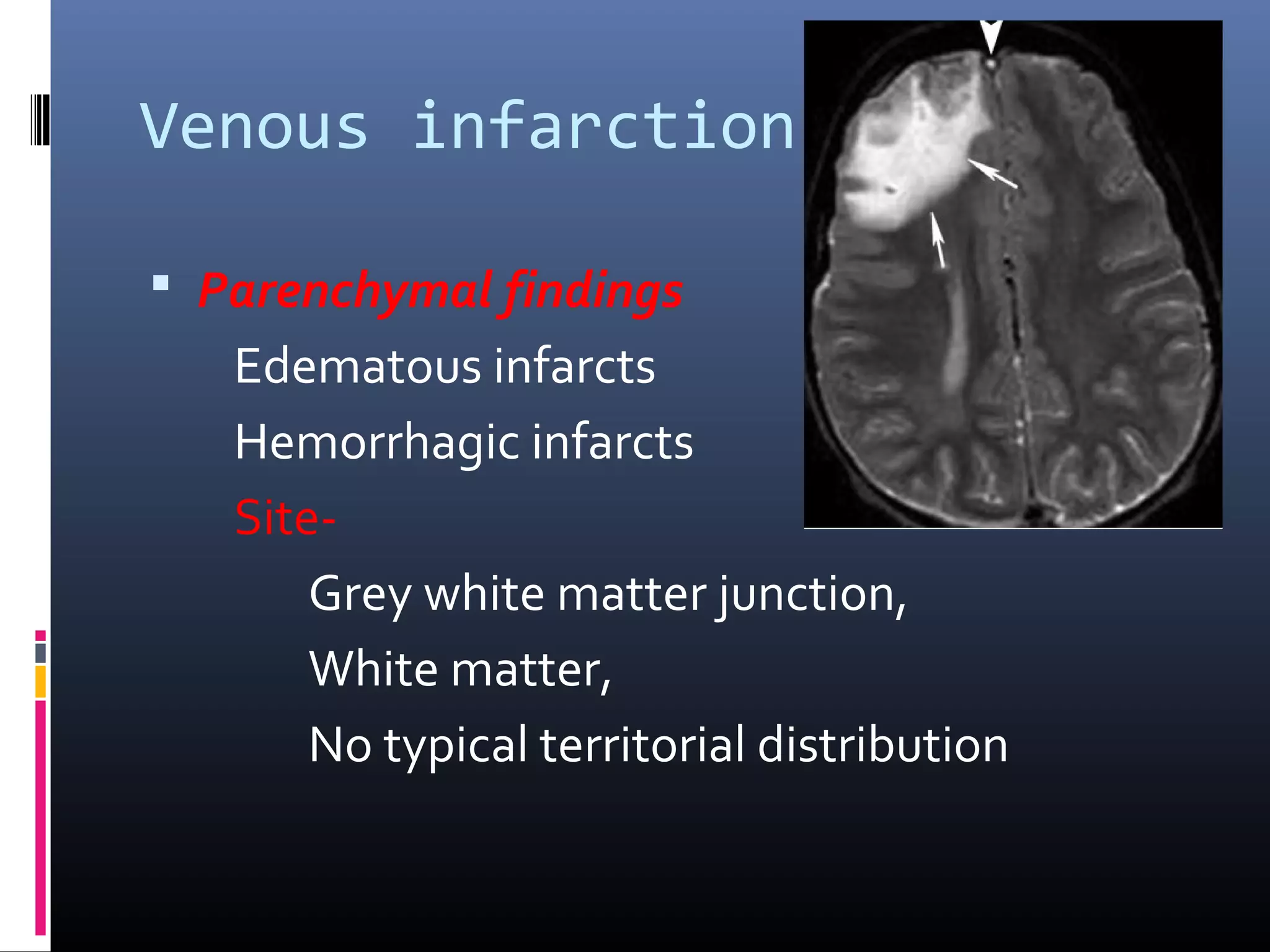 Venous infarction
 Parenchymal findings
Edematous infarcts
Hemorrhagic infarcts
Site-
Grey white matter junction,
White matter,
No typical territorial distribution
 