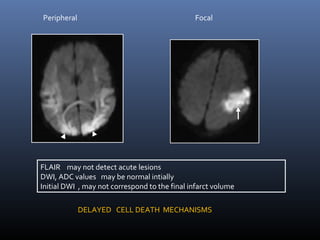 Peripheral Focal
FLAIR may not detect acute lesions
DWI, ADC values may be normal intially
Initial DWI , may not correspond to the final infarct volume
DELAYED CELL DEATH MECHANISMS
 