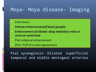 Moya- Moya disease- Imaging
Pial synangiosis- Dilated superficial
temporal and middle meningeal arteries
 Infarctions-
 Intense enhancementof basal ganglia
 Enhancement of dilated deep medullary veins in
centrum semiovale
 Pial collateral enhancement
 DSA- Puff of smoke appearance
 
