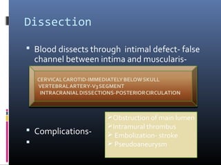 Dissection
 Blood dissects through intimal defect- false
channel between intima and muscularis-
 Complications-

Obstruction of main lumen
Intramural thrombus
 Embolization- stroke
 Pseudoaneurysm
 