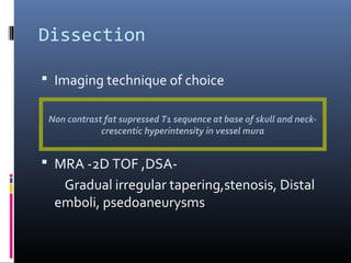 Dissection
 Imaging technique of choice
 MRA -2D TOF ,DSA-
Gradual irregular tapering,stenosis, Distal
emboli, psedoaneurysms
Non contrast fat supressed T1 sequence at base of skull and neck-
crescentic hyperintensity in vessel mura
 