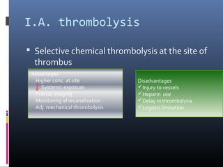 I.A. thrombolysis
 Selective chemical thrombolysis at the site of
thrombus
Advantages
Higher conc. at site
Systemic exposure
Precise imaging
Monitoring of recanalization
Adj. mechanical thrombolysis
Disadvantages
Injury to vessels
Heparin use
Delay in thrombolysis
Logistic limitation
 