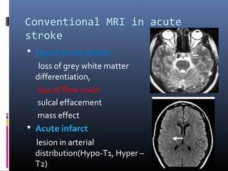 Conventional MRI in acute
stroke
 Hyperacute phase-
loss of grey white matter
differentiation,
loss of flow voids
sulcal effacement
mass effect
 Acute infarct
lesion in arterial
distribution(Hypo-T1, Hyper –
T2)
 