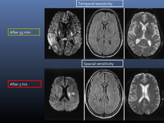 Temporal sensitivity
Spacial sensitivity
After 55 min
After 5 hrs
 