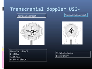 Transcranial doppler USG-
M1 and M2 of MCA
C1 of ICA
A1 of ACA
P1 and P2 of PCA
Vertebral arteries
Basilar artery
Temporal approach Suboccipital approach
 
